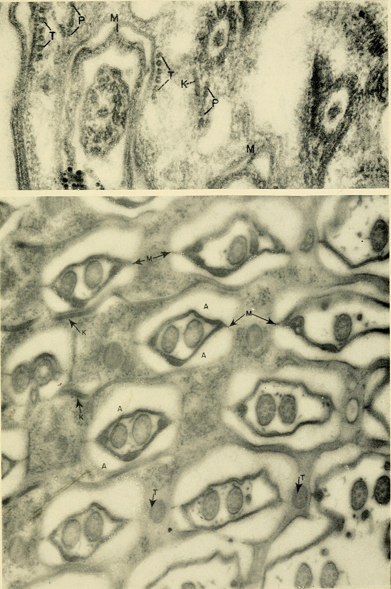 Protozoa