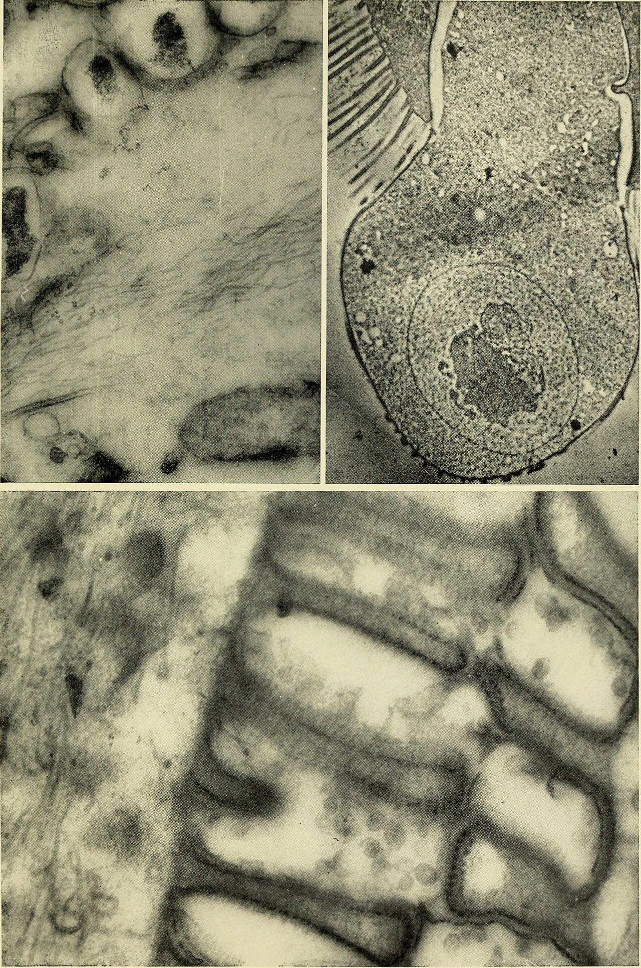 Protozoa