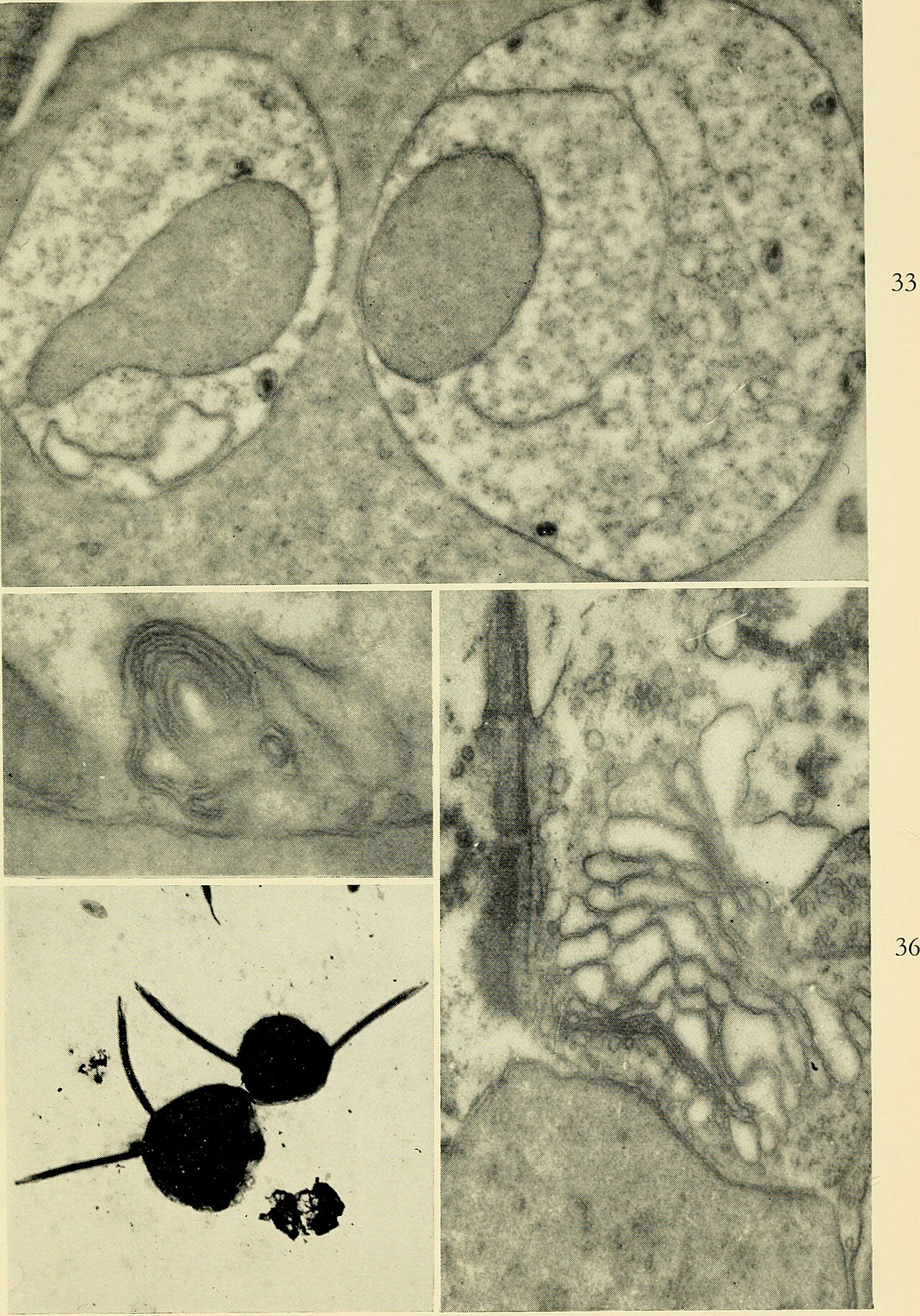 Protozoa