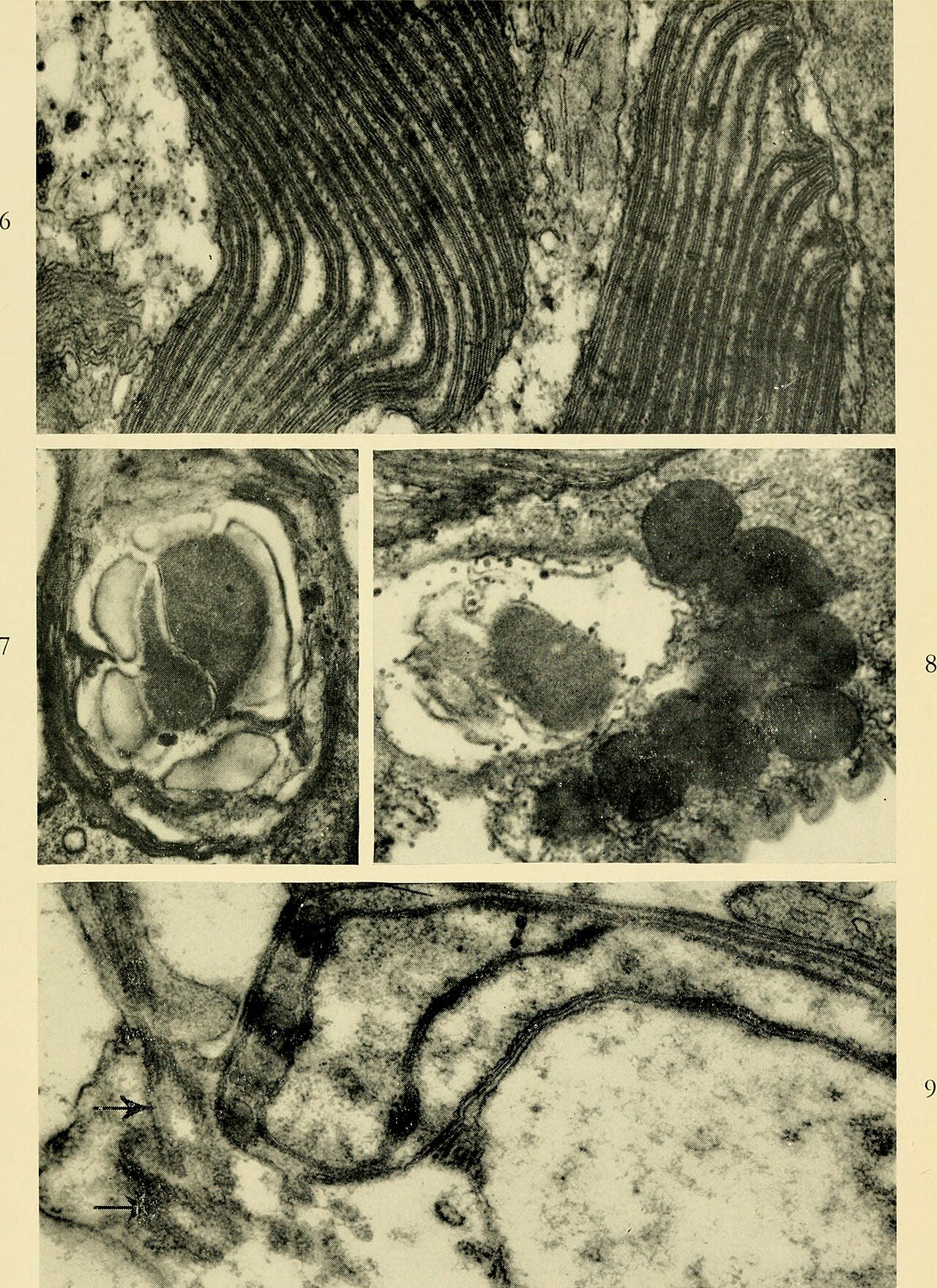 Protozoa