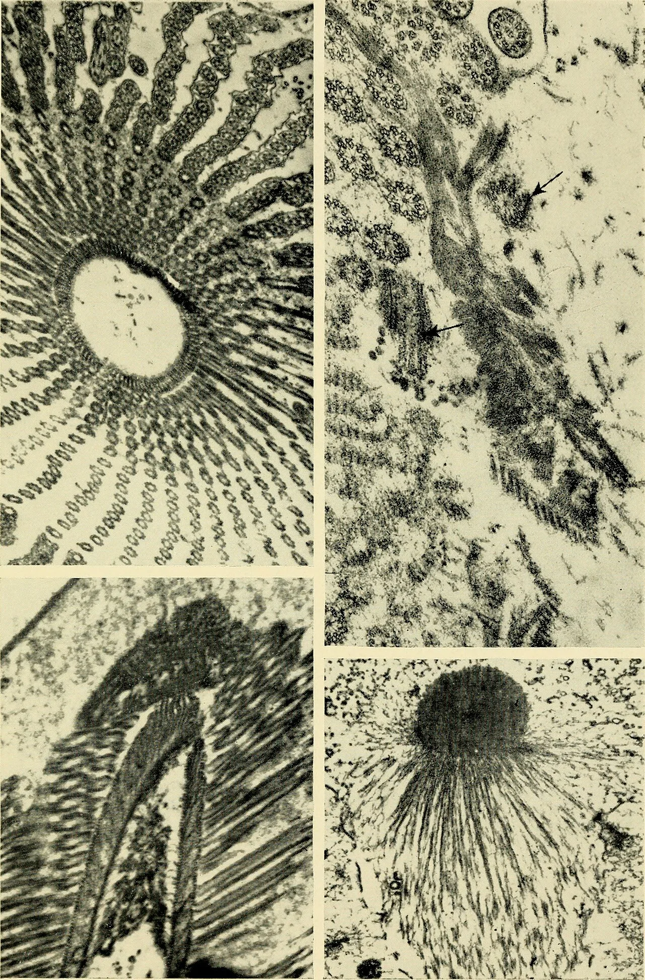 Protozoa